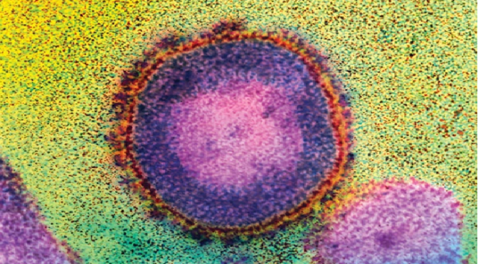 Reporte de virus de la inmunodeficiencia humana panresistente en España